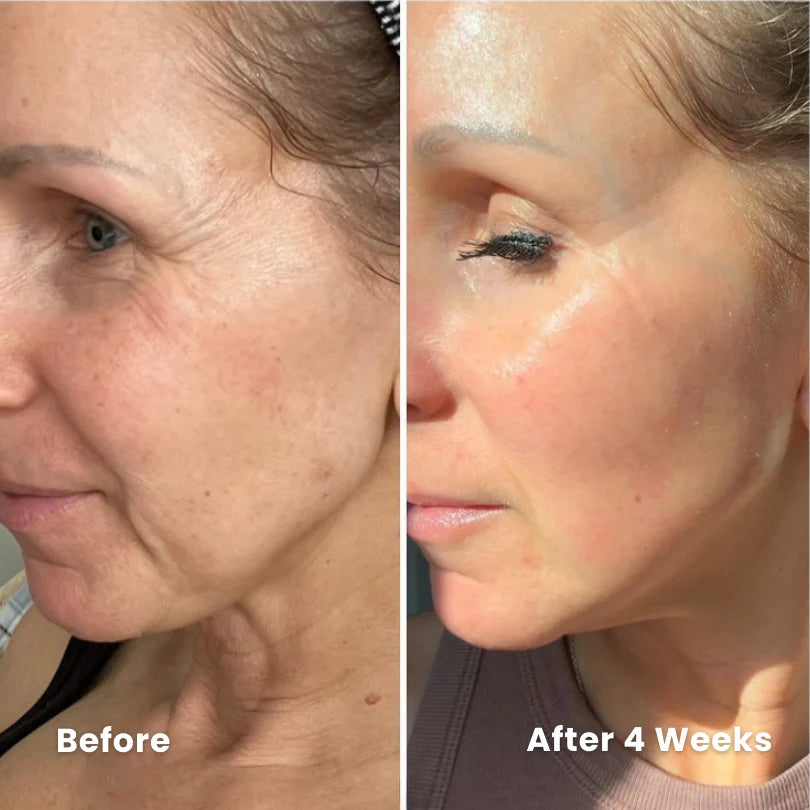 Vita-A™ Sensitive-Skin Retinal Shot