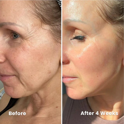 Vita-A™ Sensitive-Skin Retinal Shot
