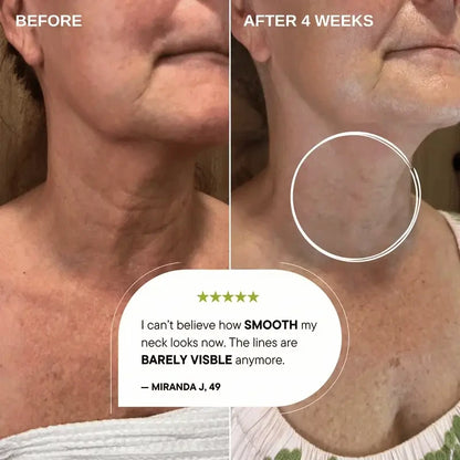 Vita-A™ Sensitive-Skin Retinal Shot